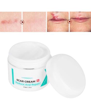 Scar Removal Cream | Stretch Marks Serum | Skin Repair Treatment - Buy Online on SooperMarket.com