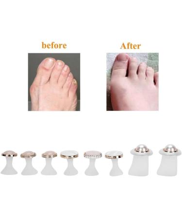 Toe Separators 8 Pcs Reusable Silicone Toe Spacers Nail Art Toe Separation Tool Pedicure Care(MY-05) - Buy Online on SooperMarket.com
