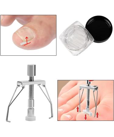 KARELLS Ingrown Toenail Correction Set Ingrown Toenails Set 12 Pieces Ingrown Toenail Lifter Ingrown Toenail Correction Treatment Set for Ingrown Toenails - Buy Online on SooperMarket.com