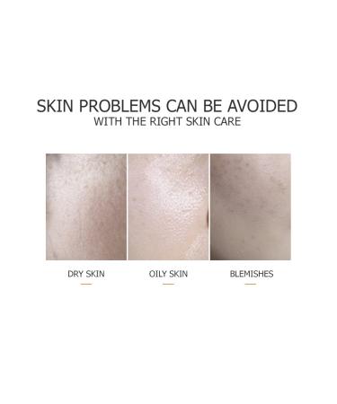 Buy VENZEN 3 Steps 24k Gold Hyaluronic Acid Mask - Oil Control Hydrating Essence | 5 Pack for International Shipping - Buy Online on SooperMarket.com