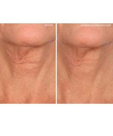 SiO Beauty Plunging Neckline - Overnight Silicone Smoothing Patches for Neck & Chest | Reusable SkinPad & Necklift - Shop Now - Buy Online on SooperMarket.com