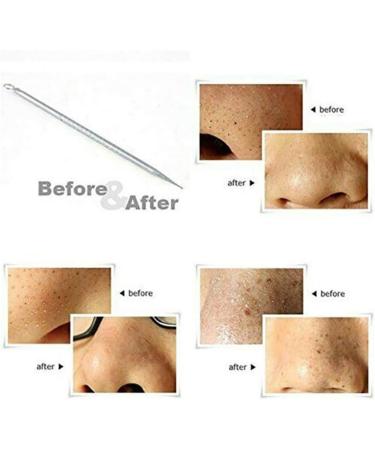 36 Acne Pimple Spot Zit Patches Face Treatment Stickers Pimple Cover Invisible Hydrocolloid Absorbing Cover Up Covering Healing Patch for Concealer Blemish Care + Free Blackhead Zit Remover Tool - Buy Online on SooperMarket.com