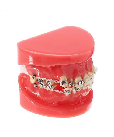 Model doll-10 orthodontic braces model study for adults standard demonstration teeth ceramic model mobile medical science teaching research