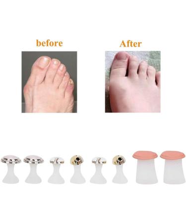 Toe Separators 8 Pcs Reusable Silicone Toe Spacers Nail Art Toe Separation Tool Pedicure Care(MY-01) - Buy Online on SooperMarket.com