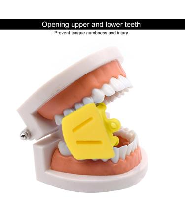 10pcs Dental Mouth Rest - Autoclave Silicone Tooth Bite Opener & Dental Retractor for Dentists - Premium Quality & Small Size - Buy Online on SooperMarket.com
