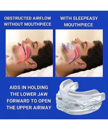 Anti Snoring Mouth Guard Adjustable Mouth Guard for Grinding Teeth & Stop Snoring a Reliable Sleep Guard for Snoring Man/Woman Transparent Mg001-transparent - Buy Online on SooperMarket.com
