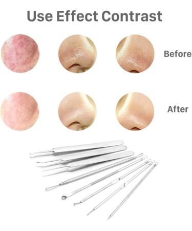 Pinkiou Blackhead Removers and Pimple Extractors Kit - 8-in-1 Skincare Tool for Face and Nose - Buy Online on SooperMarket.com