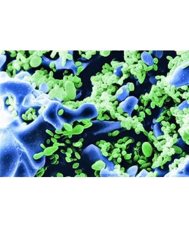 SERA SIBORAX Aquarium Filter Material 1000 ml - Organic Biological Filter Medium for Aquariums (Pack of 2) | Maximum Filtration Efficiency - Buy Online on SooperMarket.com