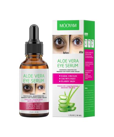 Aloe Vera Eye Serum - Eye Serum for Dark Circles and Puffiness - Hydrating and Soothing Formula for Plump - Reduce Puffiness and Fine Lines - Under Eye Serum