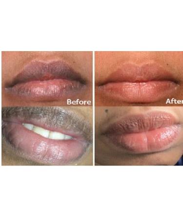 Pink Fresh Lightening Cream & Blackish Green Balm Set for Dark Lip Removal - 2PC Treatment - Buy Online on SooperMarket.com
