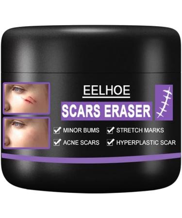 Scar Repair Cream | Acne Scar Removal | Pigmentation Corrector - 10/30/50g - Buy Online on SooperMarket.com