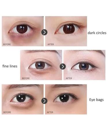 Time Eraser Rollerball - Retinol Eye Serum Oil for Fine Lines & Wrinkles | Anti-Wrinkle Eye Roll-On - Buy Online on SooperMarket.com