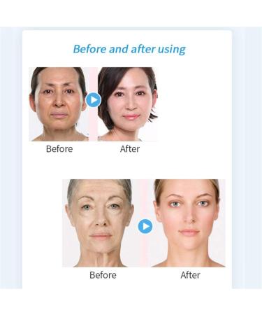 Retinol Gel Moisturizing Firming Skin Face Essence Nourishing Moisturizer Hydrating Face Cream Brightening Anti-Wrinkle Brighten Skin Color Smooth Fine Lines Suitable for All Skin Types - Buy Online on SooperMarket.com