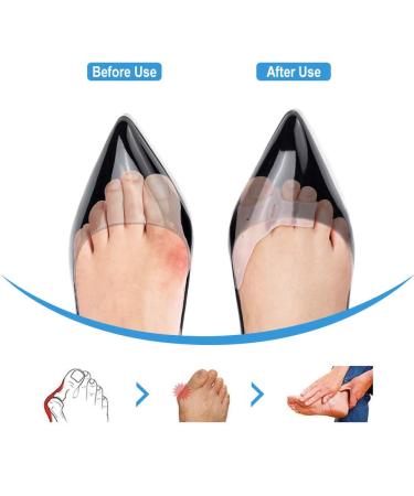 DOACT 3-Hole Bunion Corrector Protector with 5-Hole Big Toe Straighteners Gel Toe Separator Foot Splint Support for Hallux Valgus Overlapping Hammer Turf Bent Toe Day and - Buy Online on SooperMarket.com
