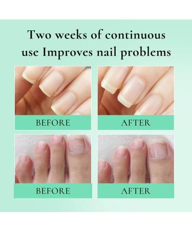 Nourishing Nail & Cuticle Oil Pen 10ml - Hydrating Repair Treatment with Natural Extracts - Buy Online on SooperMarket.com