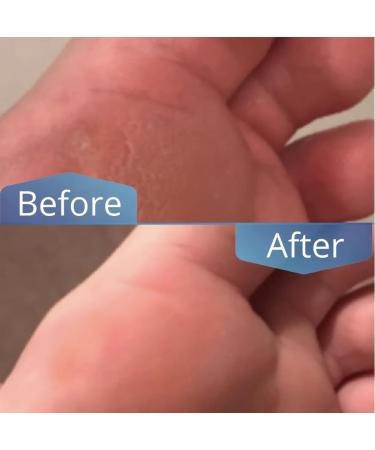 Buy Premium Honey Balm from the Netherlands - Pedicure Quality for Dry Skin Healing & Anti-Inflammatory with Pure Honey & Marigold - Buy Online on SooperMarket.com