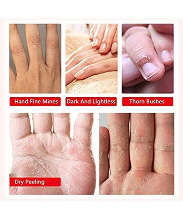 Moisturizing Hand Mask Gloves - 3-Pack Exfoliating & Moisture-Enhancing for Dry Hands | Skin Care Treatment for Rough & Dead Skin - Purple - Buy Online on SooperMarket.com