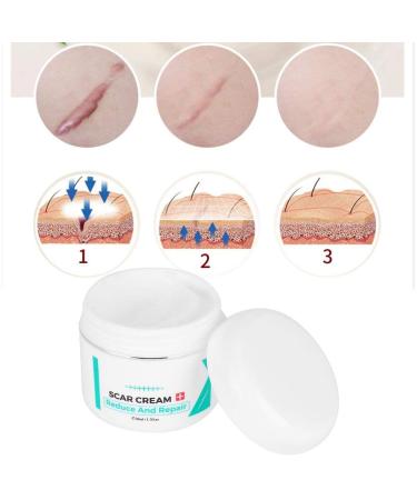 Scar Removal Cream | Stretch Marks Serum | Skin Repair Treatment - Buy Online on SooperMarket.com