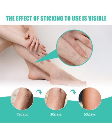 Varicose Veins Patch - Effective Treatment for Spider Veins | 12 Pcs | Fast International Shipping - Buy Online on SooperMarket.com