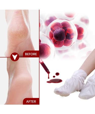 BStCar Foot Mask Socks | 5 Pairs for Men & Women | Moisturizing Foot Care Exfoliates Dead Skin & Calluses - Buy Online on SooperMarket.com