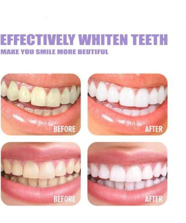 Zenglow Purple Teeth Whitening Booster - Tooth Stain Removal & Colour Corrector - Buy Online on SooperMarket.com