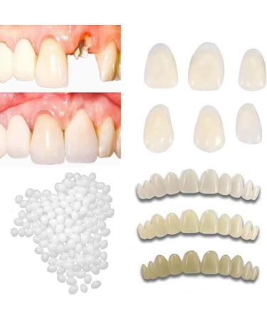 Fake Tooth Repair Kits for Filling The Missing Broken Tooth and Gaps-Moldable Fake Teeth and Thermal Beads Replacement Kits - Buy Online on SooperMarket.com