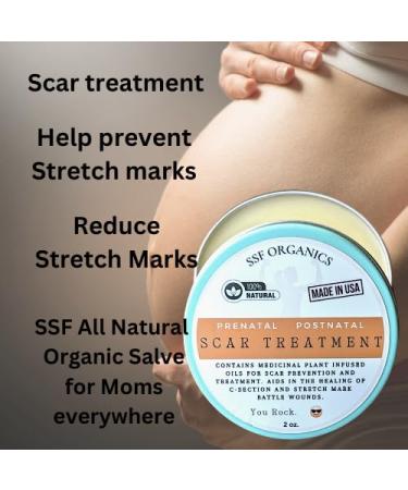 SSF Organics Scar Treatment for Stretch Marks & C-Section Recovery - Deep Moisturizing Formula with Calendula Castor Oil & Shea Butter - Advanced Care for Mama's Skin - Buy Online on SooperMarket.com