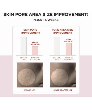 SKIN1004 Madagascar Centella Pore-minimizing Clear Toner 7.1 fl.oz - Ideal for Keratin Plug and Sensitive Skin - Buy Online on SooperMarket.com