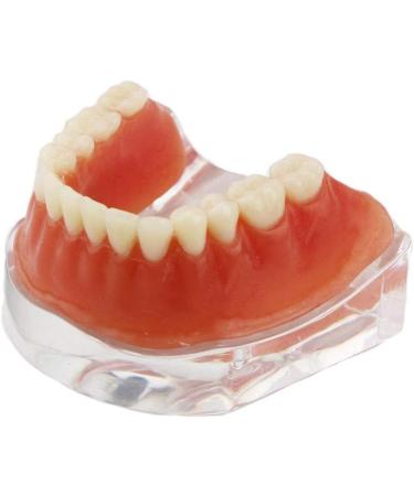 Dental Restore Model with 4 implants implant Demonstration Lower Precision Model Dental Teeth Restoration semi-Covered Prosthesis Decoration - Buy Online on SooperMarket.com
