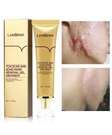 AKARY Acne Scar Removal Cream  Herbal Fade Scar Marks Burns Repair Cream  Stretch Marks Face Skin Cream Shrink Pores Gel  Old and New Scars Skin Repair Gel Skin Care