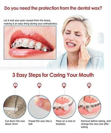 Angzhili 10 Pack Dental Orthodontics Wax for Brace Wearers Gum Protection (Multi-Color) - Buy Online on SooperMarket.com