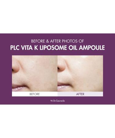 Leegeehaam PLC Vitamin K Liposome Oil Ampoule - Toning, Glowing, Hydrating Serum for Brighter Skin | Dr.Ceuracle - Buy Online on SooperMarket.com