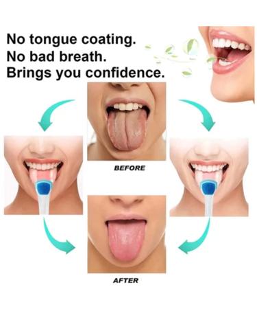 Probiotic Tongue Cleaning Gel Set with Tongue Scraper and Brush Kit - Mint Flavor | Oral Hygiene Brush and Tongue Cleaner Set - Buy Online on SooperMarket.com