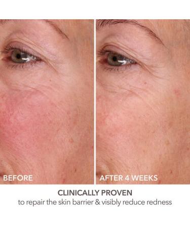 Dr. Dennis Gross DermInfusions Fill + Repair Serum - 1 oz | Fills Lines, Plumps, and Repairs - Buy Online on SooperMarket.com