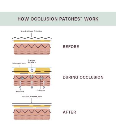 Buy Dermaclara Silicone Stretch Marks Patch Kit - Effective One Patch Solution for Scars | International Shipping Available - Buy Online on SooperMarket.com