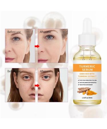 Turmeric face seruem Dark Spot Remover Essence Turmeric Serums for face Brightens Skin Tone Moisturizes Hydrates Lightens Age-Spots Acne Reduce Fine Lines Facial Care Anti-Aging Serum - Buy Online on SooperMarket.com