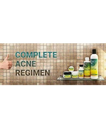Acne Zap Scalp Shampoo - Clear Scalp from Zits and Pimples 6.0 oz - Buy Online on SooperMarket.com