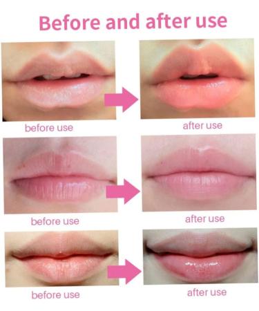 Face Masks Gel Lip Pad Hot Cold Compress Gel Pack Reusable Leakage Proof Swelling Wounds Patches - Buy Online on SooperMarket.com