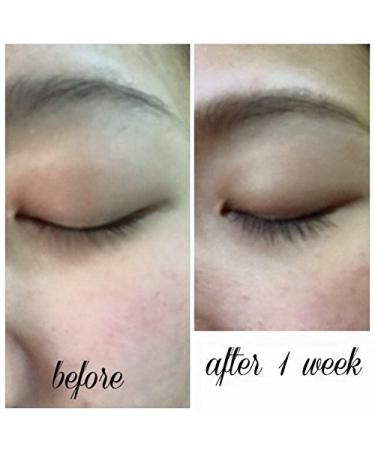 LuxeLash Select Lash Serum - Eyelash Rejuvenator for Fuller, Healthier Lashes - Buy Online on SooperMarket.com