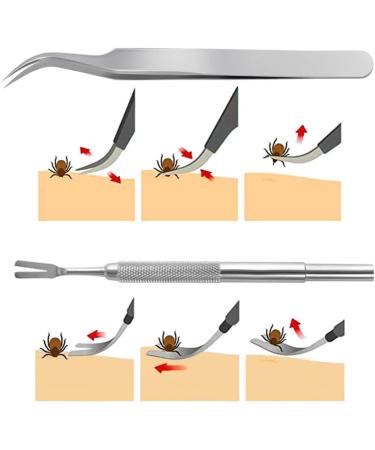 PAIDASHU Tick Remover Stainless Steel Tick Remover Tick Removal Tool for Dogs Cats Horses Tick Hook Kit Included Removal Tweezers+ Tick Shovel+ Iron Box - Buy Online on SooperMarket.com