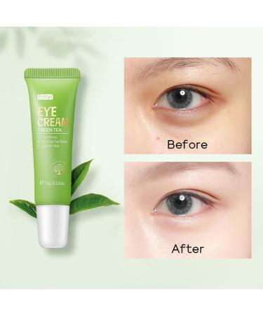 AKARY Green Tea Eye Care Cream - Eliminate Dark Circles & Eye Bags | Nourishing & Tightening Formula with Tea Leaf Extract - Buy Online on SooperMarket.com