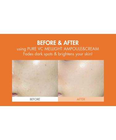 Dr.Ceuracle Pure Vitamin C Mellight Cream | Tone-Up Serum for Face | Anti-Aging Moisturizer | Brighten Dark Spots & Wrinkles | Paraben-Free | Shop Internationally - Buy Online on SooperMarket.com