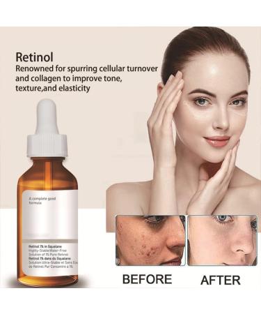 Retinol Serum For Face/Neck/Eyes - Retinol 1% in Squalane 30ml - High-Strength Face Serum for Activate Skin- Anti Aging Facial Serum for Moisturizing Fine Line Skin Repair - Buy Online on SooperMarket.com