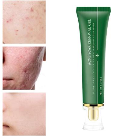 Acne Scar Removal Gel Face Body Marks Skin Repair Cream Acne Treatment Essence 30g acne removal cream - Buy Online on SooperMarket.com