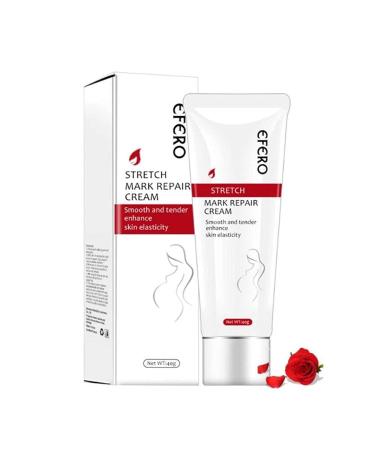 Stretch Marks Removal Cream Women Bad Sign Pregnancy Marks Acne Marks Remove Moisturizing Firming Body Skin