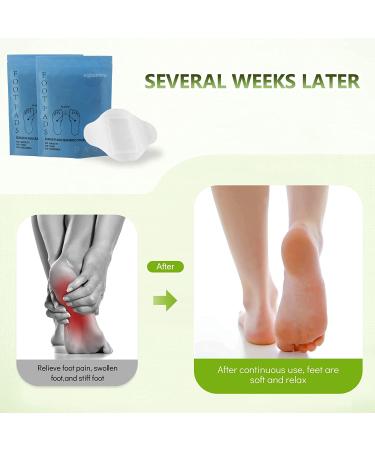 Dtox Foot Pads 28 Pcs - Anti-Swelling Ginger Patch for Better Sleep and Stress Relief - Buy Online on SooperMarket.com