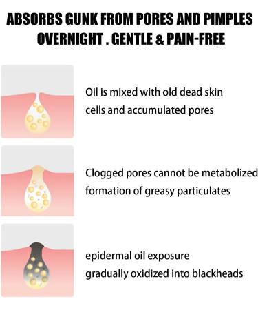 Pore Cleansing Strips - 10pcs Hydrocolloid Blackhead Remover Patches for Oily Skin - Buy Online on SooperMarket.com