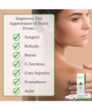 Kelosoft - Natural Scar Removal Cream Keloid Scar Removal Gel Plant Based Herbal Scar Cream Helps Reduce Visibility of Scars - 25g - Buy Online on SooperMarket.com