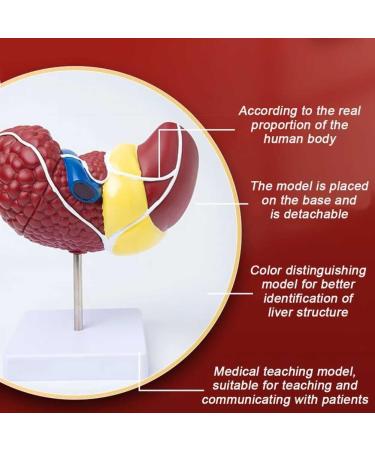 Teaching Model Human Liver Educational Model with Base and Clear Texture and Pathological Features Liver Cirrhosis Model for Medical School Study and Research - Buy Online on SooperMarket.com