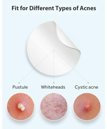 LitBear Acne Pimple Patches - Day and Night Set | 180 Dots with Witch Hazel, Tea Tree & Calendula Oil | Extra Adhesion for Face | Zit Patch AM + PM - Buy Online on SooperMarket.com